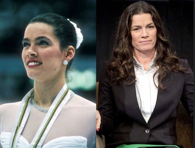 Nancy Kerrigan